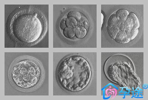 为什么试管婴儿要养囊，囊胚移植成功率略高？