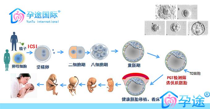 第三代试管婴儿（PGT）胚胎活检及意义